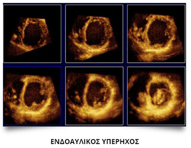 ΚΑΡΑΓΚΟΥΝΗΣ Α. ΛΑΜΠΡΟΣ: Φωτογραφίες & Βίντεο