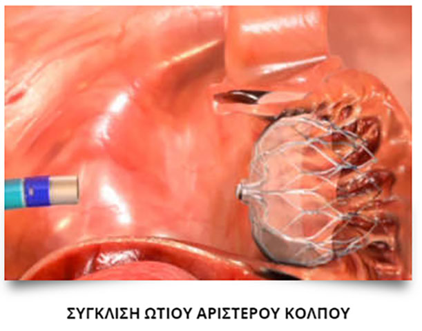 ΚΑΡΑΓΚΟΥΝΗΣ Α. ΛΑΜΠΡΟΣ: Φωτογραφίες & Βίντεο