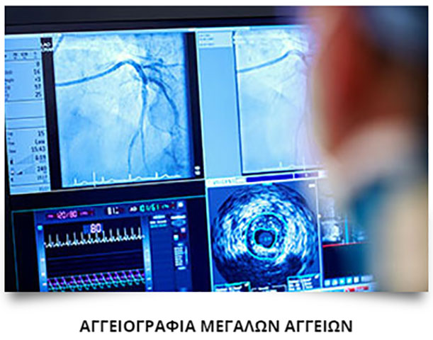 ΚΑΡΑΓΚΟΥΝΗΣ Α. ΛΑΜΠΡΟΣ: Φωτογραφίες & Βίντεο