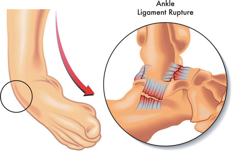 KASIMATIS GEORGIOS, FEBOT, FEBHS - ORTHOPEDICARE: Φωτογραφίες & Βίντεο