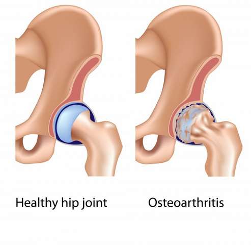 KASIMATIS GEORGIOS, FEBOT, FEBHS - ORTHOPEDICARE: Φωτογραφίες & Βίντεο