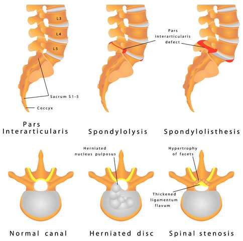 KASIMATIS GEORGIOS, FEBOT, FEBHS - ORTHOPEDICARE: Φωτογραφίες & Βίντεο