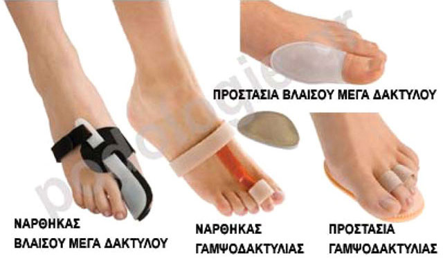 Specialized protection guards, splints for lower limb problems