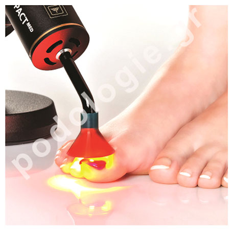 PACT MED, an alternative treatment of onychomycosis without side effects