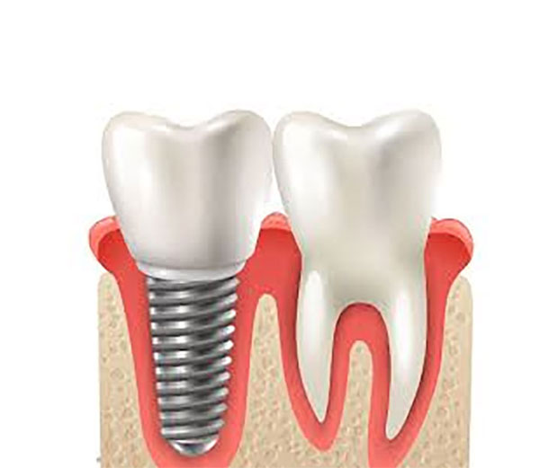 ΚΙΟΚΠΑΣΟΓΛΟΥ ΜΑΓΔΑ DDS MSc Dr MED DENT: Φωτογραφίες & Βίντεο