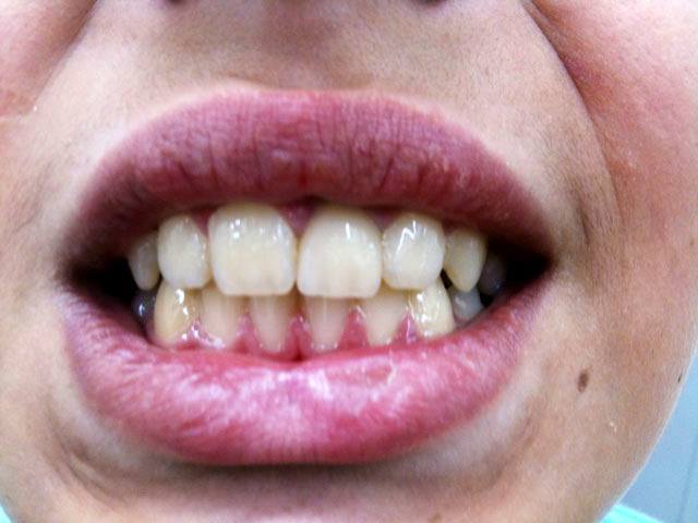 KN DENTAL - ΚΑΛΤΣΑΣ ΝΙΚΟΛΑΟΣ: Φωτογραφίες & Βίντεο