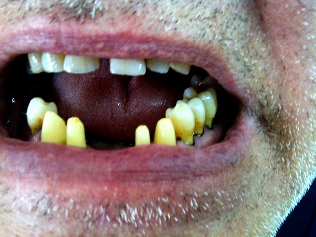 KN DENTAL - ΚΑΛΤΣΑΣ ΝΙΚΟΛΑΟΣ: Φωτογραφίες & Βίντεο