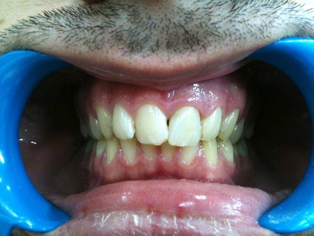 KN DENTAL - ΚΑΛΤΣΑΣ ΝΙΚΟΛΑΟΣ: Φωτογραφίες & Βίντεο