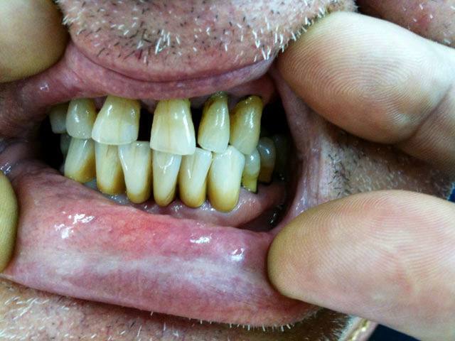 KN DENTAL - ΚΑΛΤΣΑΣ ΝΙΚΟΛΑΟΣ: Φωτογραφίες & Βίντεο