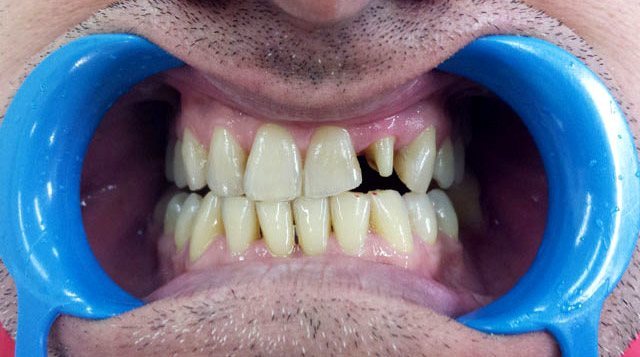 KN DENTAL - ΚΑΛΤΣΑΣ ΝΙΚΟΛΑΟΣ: Φωτογραφίες & Βίντεο