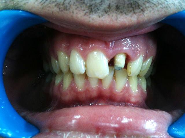 KN DENTAL - ΚΑΛΤΣΑΣ ΝΙΚΟΛΑΟΣ: Φωτογραφίες & Βίντεο