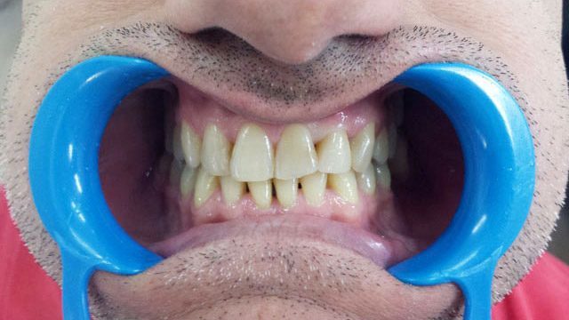 KN DENTAL - ΚΑΛΤΣΑΣ ΝΙΚΟΛΑΟΣ: Φωτογραφίες & Βίντεο