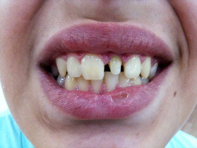 KN DENTAL - ΚΑΛΤΣΑΣ ΝΙΚΟΛΑΟΣ: Φωτογραφίες & Βίντεο