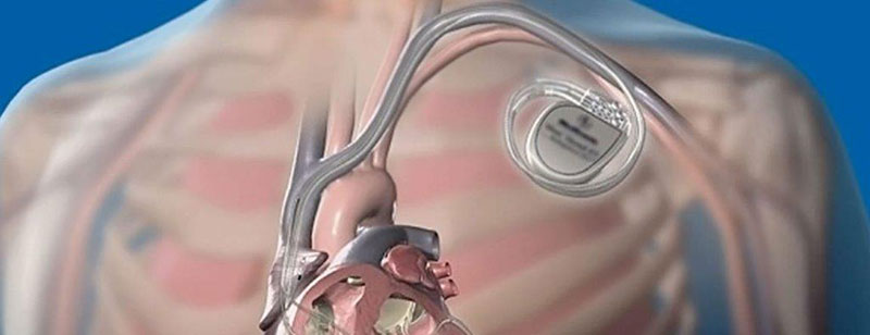 KONTOS Ch. VASILEIOS MD, MSc: Φωτογραφίες & Βίντεο