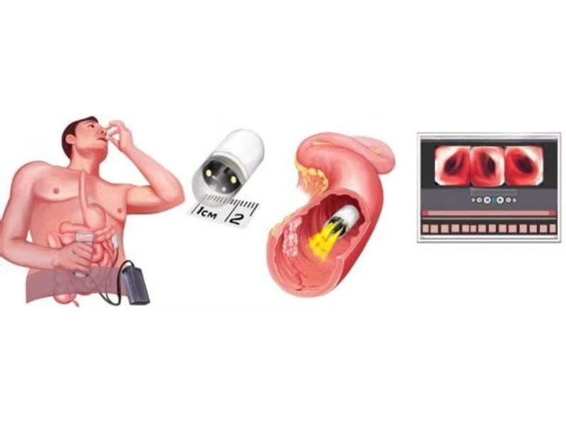 KOUMOUTSOS IOANNIS DR (MD, MSc, FEBGH): Φωτογραφίες & Βίντεο