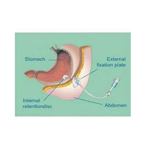 KOUMOUTSOS IOANNIS DR (MD, MSc, FEBGH): Φωτογραφίες & Βίντεο