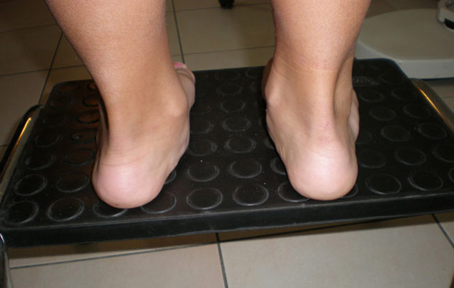 Pes Planus and Hallux Valgus