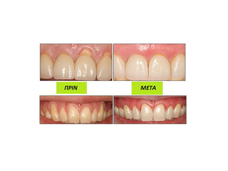 ΛΑΜΠΙΔΟΥ ΕΛΕΝΑ DDS, MSc: Φωτογραφίες & Βίντεο