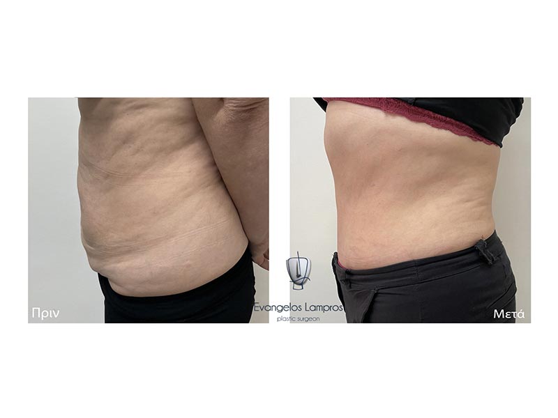 LAMPROS EVAGGELOS MD, MSc, PhDc: Φωτογραφίες & Βίντεο
