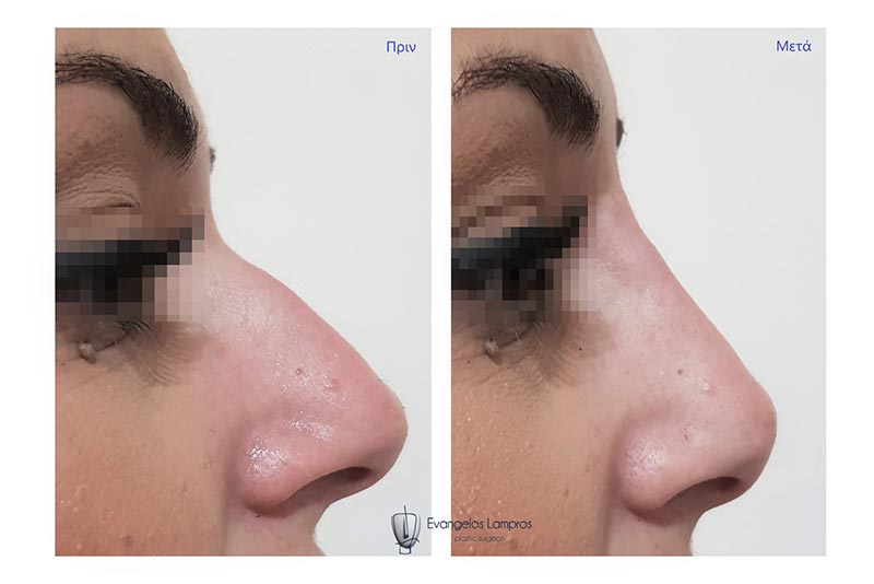 LAMPROS EVAGGELOS MD, MSc, PhDc: Φωτογραφίες & Βίντεο