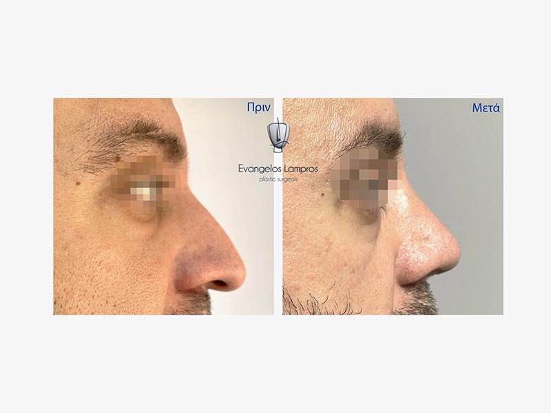 LAMPROS EVAGGELOS MD, MSc, PhDc: Φωτογραφίες & Βίντεο