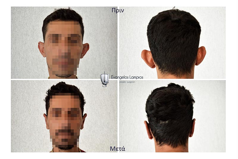 LAMPROS EVAGGELOS MD, MSc, PhDc: Φωτογραφίες & Βίντεο