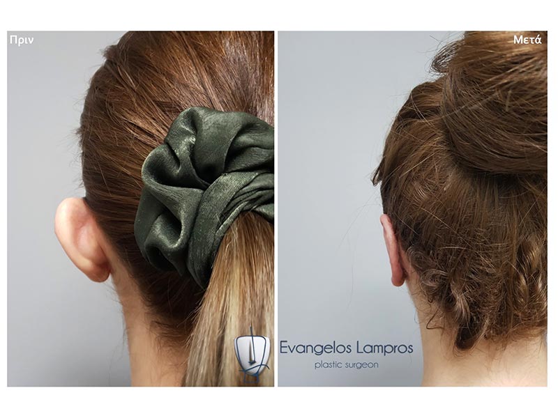 LAMPROS EVAGGELOS MD, MSc, PhDc: Φωτογραφίες & Βίντεο