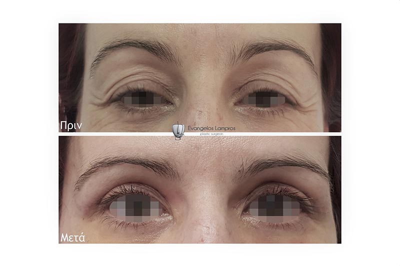 LAMPROS EVAGGELOS MD, MSc, PhDc: Φωτογραφίες & Βίντεο