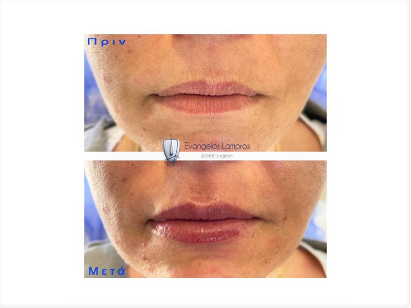 LAMPROS EVAGGELOS MD, MSc, PhDc: Φωτογραφίες & Βίντεο