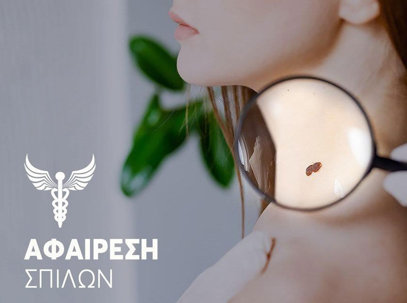 ΛΑΠΙΔΑΚΗΣ ΓΕΩΡΓΙΟΣ - SURGICLINIC: Φωτογραφίες & Βίντεο