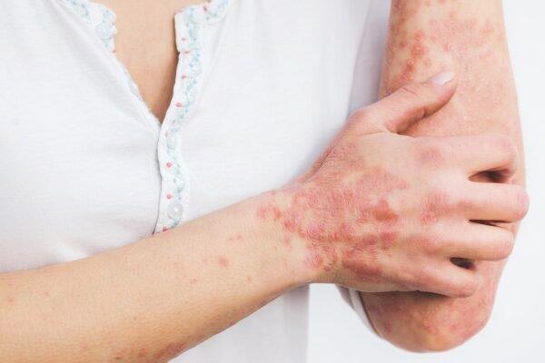 LASER DERMA TREATMENT: Φωτογραφίες & Βίντεο