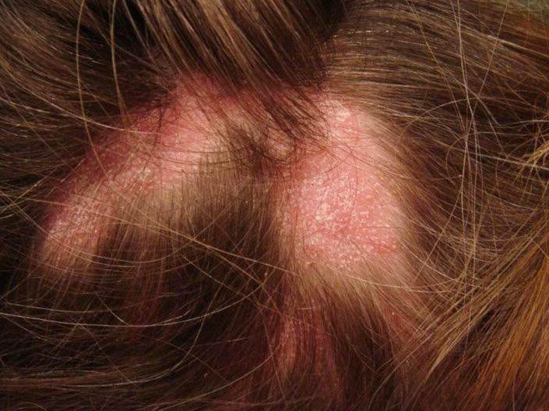 LASER DERMA TREATMENT: Φωτογραφίες & Βίντεο