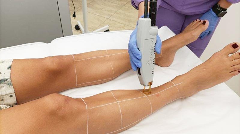 LASER DERMA TREATMENT: Φωτογραφίες & Βίντεο