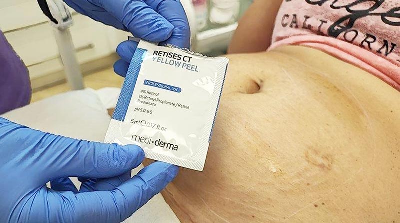 LASER DERMA TREATMENT: Φωτογραφίες & Βίντεο