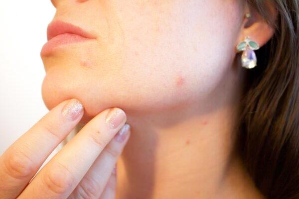 LASER DERMA TREATMENT: Φωτογραφίες & Βίντεο