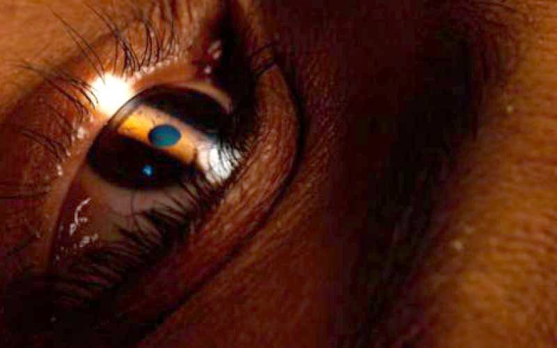 LASER EYE - ΠΑΠΑΜΑΣΤΟΡΑΚΗΣ ΓΕΩΡΓΙΟΣ: Φωτογραφίες & Βίντεο