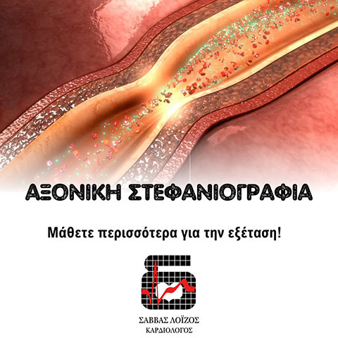 LOIZOS SAVVAS - KARDIODIAGNOSI: Φωτογραφίες & Βίντεο
