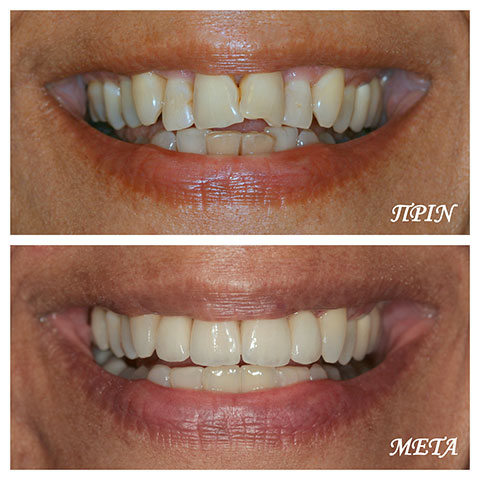 ΜΑΡΓΑΡΙΤΗ ΜΑΡΙΑ - DENTAL PROLIPSIS: Φωτογραφίες & Βίντεο