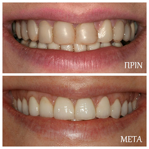 ΜΑΡΓΑΡΙΤΗ ΜΑΡΙΑ - DENTAL PROLIPSIS: Φωτογραφίες & Βίντεο