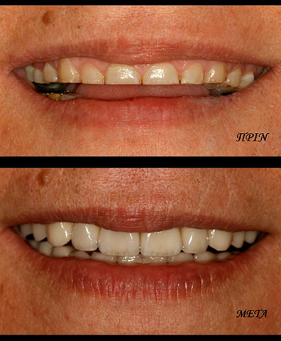 ΜΑΡΓΑΡΙΤΗ ΜΑΡΙΑ - DENTAL PROLIPSIS: Φωτογραφίες & Βίντεο