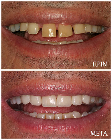 ΜΑΡΓΑΡΙΤΗ ΜΑΡΙΑ - DENTAL PROLIPSIS: Φωτογραφίες & Βίντεο