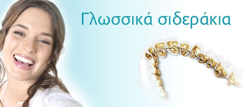 Γλωσσικά σιδεράκια