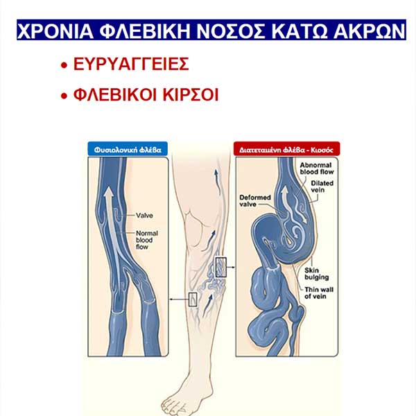 ΜΑΡΤΙΝΑΚΗΣ Γ. ΒΑΣΙΛΕΙΟΣ PhD, MSc, FEBVS: Φωτογραφίες & Βίντεο