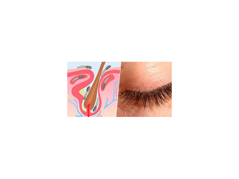 ΜΑΥΡΟΥΔΗΣ ΛΕΩΝΙΔΑΣ - LASER MICROSURGERY VISION: Φωτογραφίες & Βίντεο
