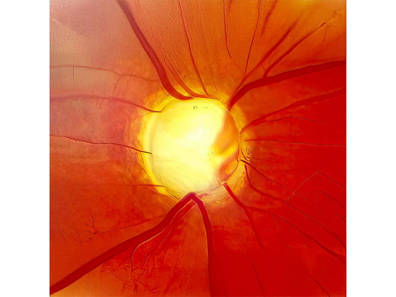 ΜΑΥΡΟΥΔΗΣ ΛΕΩΝΙΔΑΣ - LASER MICROSURGERY VISION: Φωτογραφίες & Βίντεο