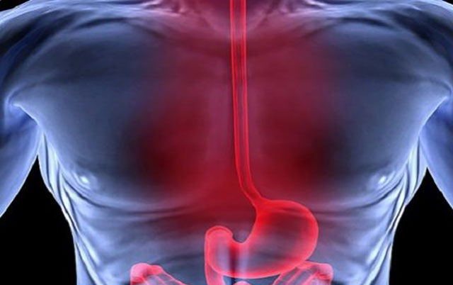 Treatment of gastroesophageal reflux disease, diaphragmatic hernia