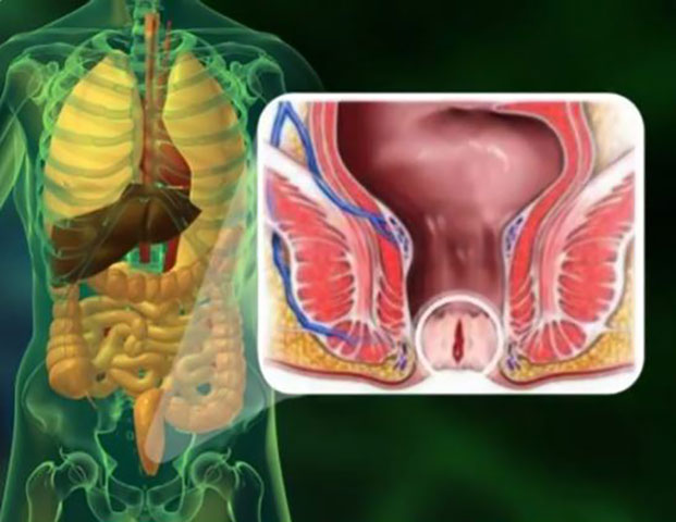 Anal fissure, treatment