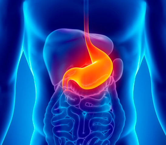 Laparoscopic cholecystectomy and treatment of cholelithiasis