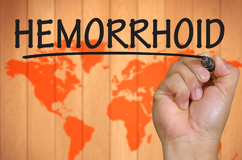 Treatment of hemorrhoids
