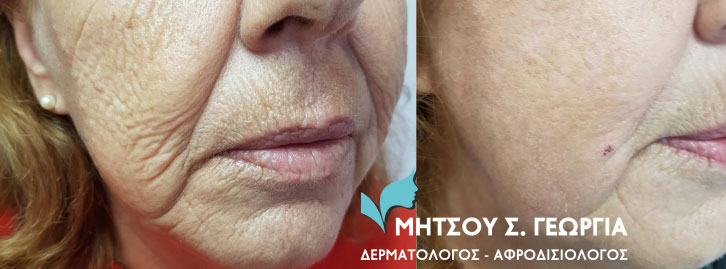 ΜΗΤΣΟΥ ΓΕΩΡΓΙΑ: Φωτογραφίες & Βίντεο